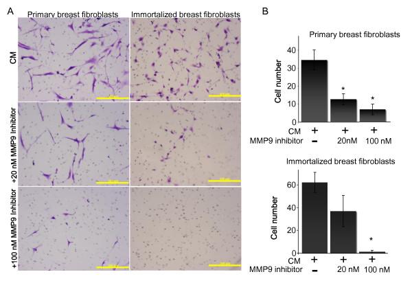 https://cdn.ncbi.nlm.nih.gov/pmc/blobs/80cd/3446360/f07c17850ce5/bcr3215-7.jpg