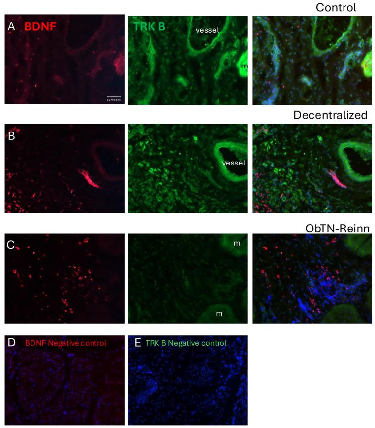 https://cdn.ncbi.nlm.nih.gov/pmc/blobs/80cf/11941061/680722a22fd4/cells-14-00406-g007.jpg