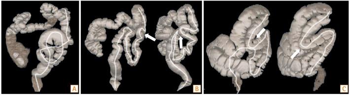 https://cdn.ncbi.nlm.nih.gov/pmc/blobs/80cf/5430017/c8212c114aae/ir-15-236-g002.jpg