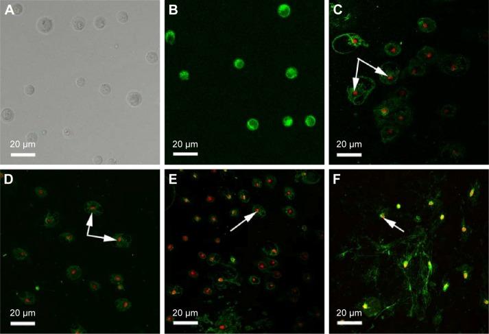 https://cdn.ncbi.nlm.nih.gov/pmc/blobs/80d6/5315215/2a891ab59f6d/ijn-12-1183Fig7.jpg