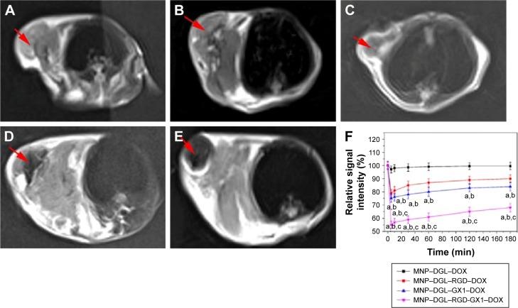 https://cdn.ncbi.nlm.nih.gov/pmc/blobs/80d6/5315215/846aba8effed/ijn-12-1183Fig10.jpg