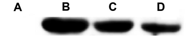 https://cdn.ncbi.nlm.nih.gov/pmc/blobs/80de/5588068/5fd191a6252a/ol-14-03-3510-g01.jpg