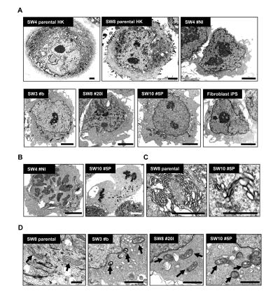 https://cdn.ncbi.nlm.nih.gov/pmc/blobs/80df/3292906/c911ca1e7fe4/aging-04-060-g004.jpg