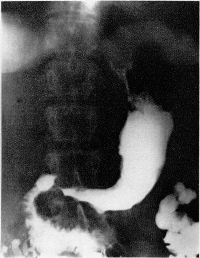 https://cdn.ncbi.nlm.nih.gov/pmc/blobs/80e0/2087730/4738f5997adf/brmedj04302-0032-c.jpg