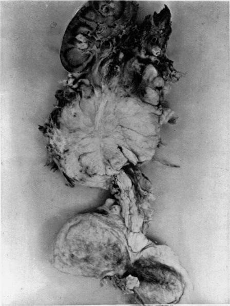 https://cdn.ncbi.nlm.nih.gov/pmc/blobs/80e0/2087730/522f957244d0/brmedj04302-0032-e.jpg