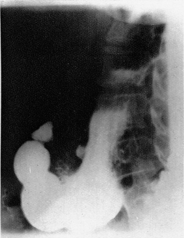 https://cdn.ncbi.nlm.nih.gov/pmc/blobs/80e0/2087730/bfa1bac40d9b/brmedj04302-0032-a.jpg