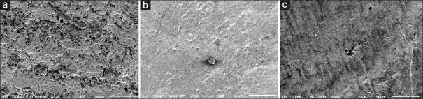 https://cdn.ncbi.nlm.nih.gov/pmc/blobs/80e1/6596179/6d7284e5e3a1/DRJ-16-239-g003.jpg