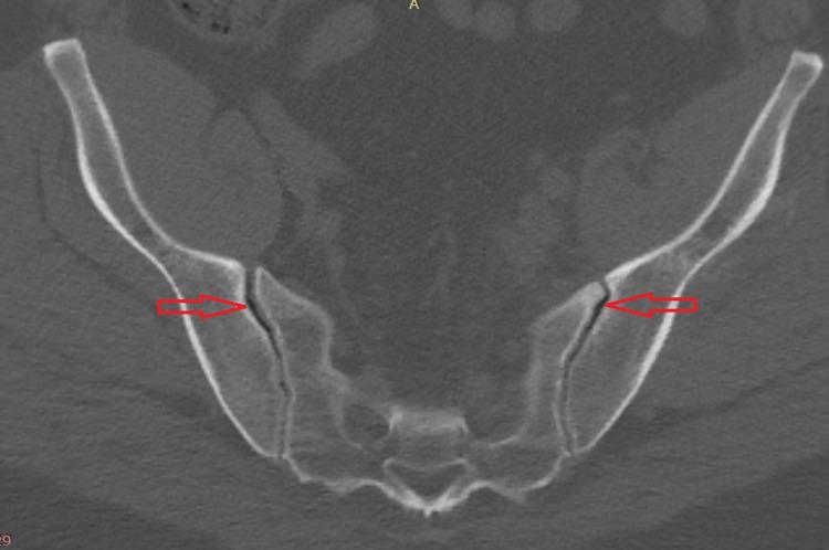 https://cdn.ncbi.nlm.nih.gov/pmc/blobs/80e9/8282264/a1212074d6cc/cureus-0013-00000016408-i01.jpg