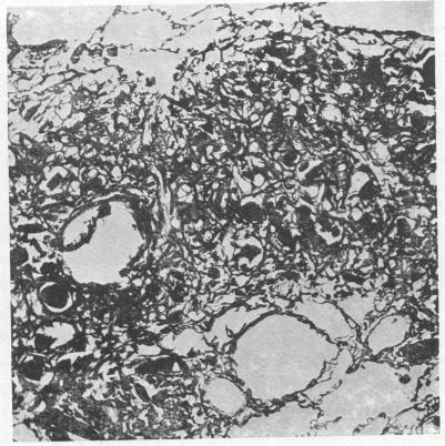 https://cdn.ncbi.nlm.nih.gov/pmc/blobs/8103/1036399/21b9eab3c15c/brjindmed00242-0021-b.jpg