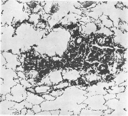 https://cdn.ncbi.nlm.nih.gov/pmc/blobs/8103/1036399/627efc402b3f/brjindmed00242-0022-a.jpg