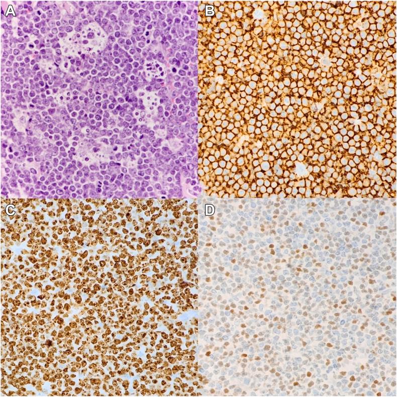 https://cdn.ncbi.nlm.nih.gov/pmc/blobs/8103/12268556/d10682108fe1/gr3.jpg