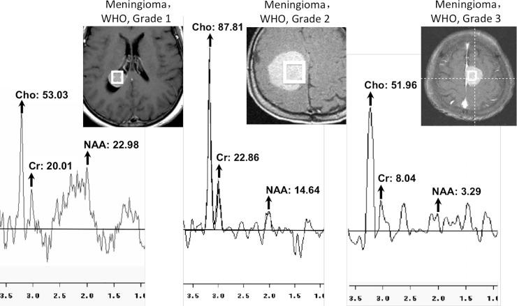 https://cdn.ncbi.nlm.nih.gov/pmc/blobs/810c/6242682/dd2ae1c35fe6/pone.0207612.g001.jpg