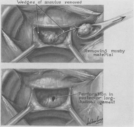 https://cdn.ncbi.nlm.nih.gov/pmc/blobs/810d/1513826/825c646efb02/annsurg01360-0161-a.jpg