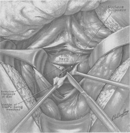 https://cdn.ncbi.nlm.nih.gov/pmc/blobs/810d/1513826/d2b187068626/annsurg01360-0160-a.jpg