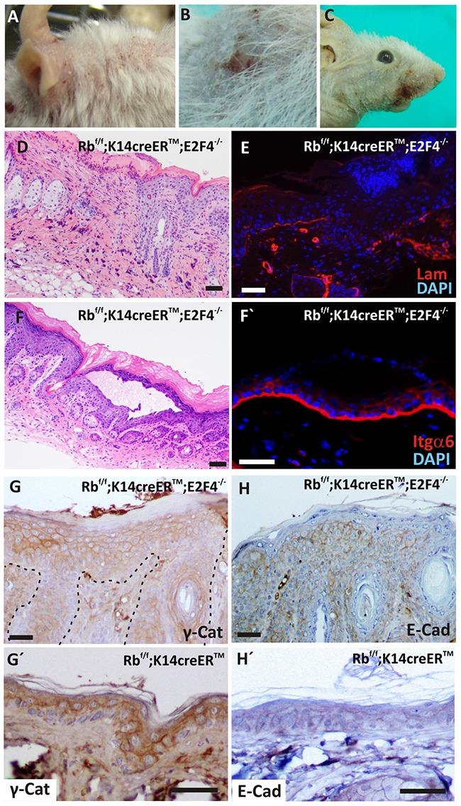 https://cdn.ncbi.nlm.nih.gov/pmc/blobs/810d/5342772/14376171b1cd/oncotarget-07-75712-g002.jpg