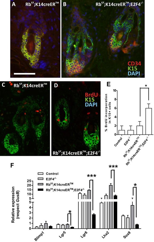 https://cdn.ncbi.nlm.nih.gov/pmc/blobs/810d/5342772/23eebf47e71e/oncotarget-07-75712-g005.jpg