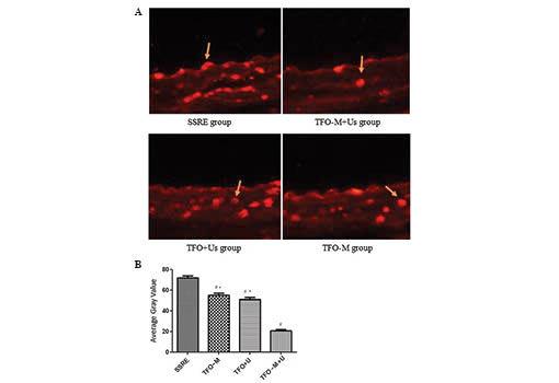 https://cdn.ncbi.nlm.nih.gov/pmc/blobs/810f/4262506/e7d876b9054c/MMR-11-02-0903-g05.jpg