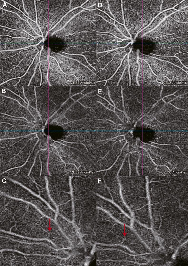 https://cdn.ncbi.nlm.nih.gov/pmc/blobs/8111/10847056/6e5279d38d54/gr1.jpg