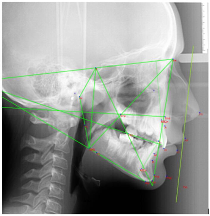 https://cdn.ncbi.nlm.nih.gov/pmc/blobs/8113/11675019/9c00544dd508/dentistry-12-00411-g003.jpg