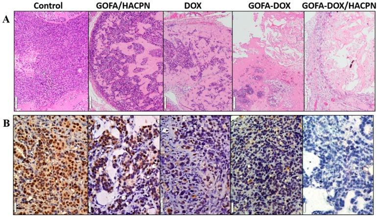 https://cdn.ncbi.nlm.nih.gov/pmc/blobs/8114/5707605/5120a5b2d072/nanomaterials-07-00388-g010.jpg