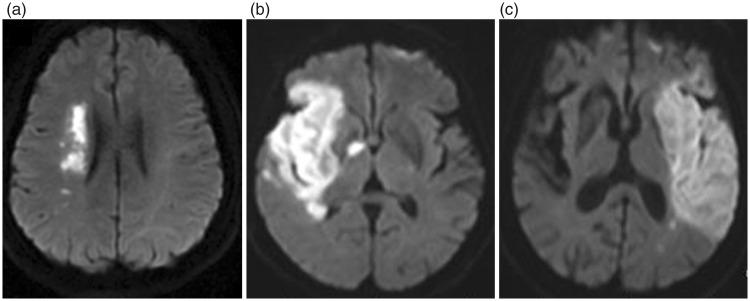 https://cdn.ncbi.nlm.nih.gov/pmc/blobs/8117/6567759/9ca7f692e6e0/10.1177_0300060519827173-fig1.jpg