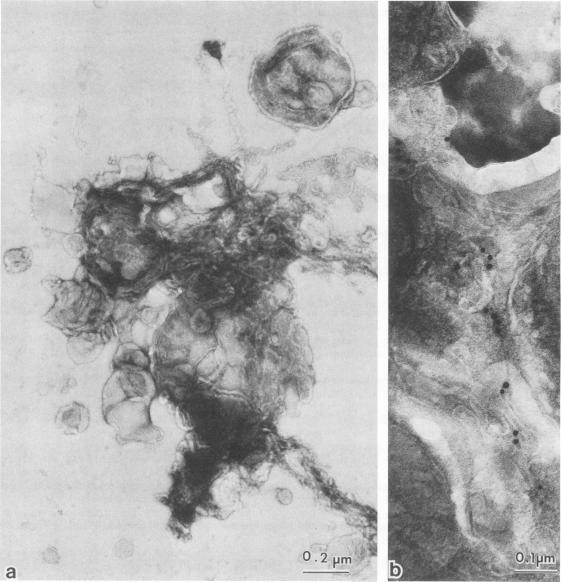https://cdn.ncbi.nlm.nih.gov/pmc/blobs/8119/255197/2dc3d7ec5ed9/jvirol00092-0064-a.jpg