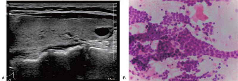 https://cdn.ncbi.nlm.nih.gov/pmc/blobs/811e/7886408/23f72480644a/medi-100-e24458-g002.jpg