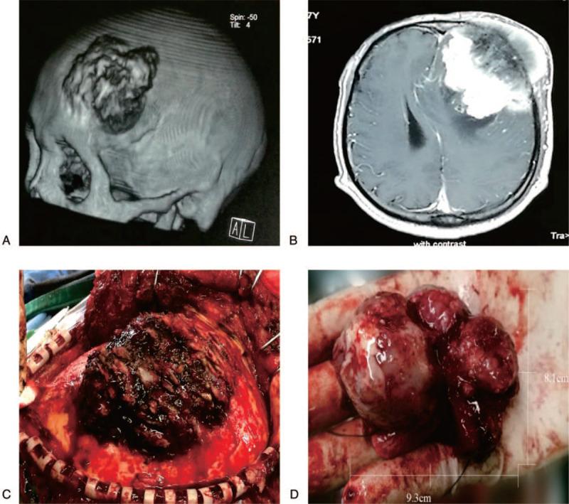 https://cdn.ncbi.nlm.nih.gov/pmc/blobs/811e/7886408/d980d347b3f3/medi-100-e24458-g001.jpg