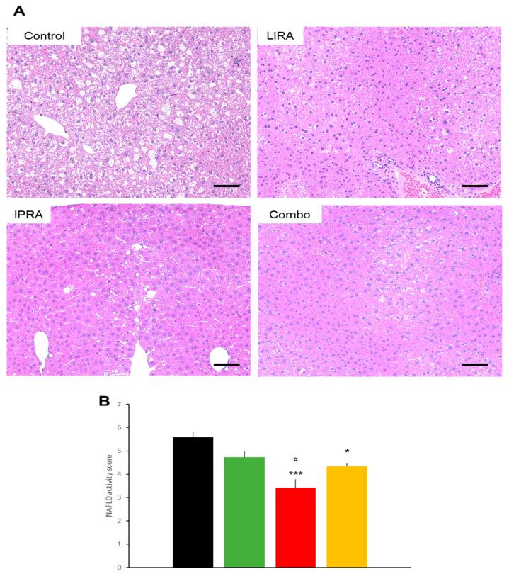 https://cdn.ncbi.nlm.nih.gov/pmc/blobs/8122/8583813/1dc0ea2db73a/ijms-22-11463-g008.jpg
