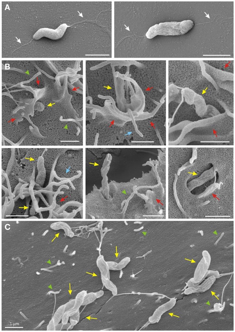 https://cdn.ncbi.nlm.nih.gov/pmc/blobs/8133/3417370/7bfabdaa8699/fcimb-01-00017-g003.jpg