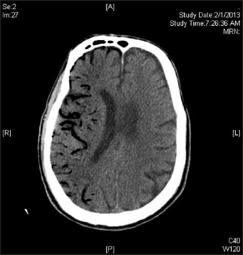 https://cdn.ncbi.nlm.nih.gov/pmc/blobs/813d/3992779/3a303a754729/AIAN-17-89-g002.jpg