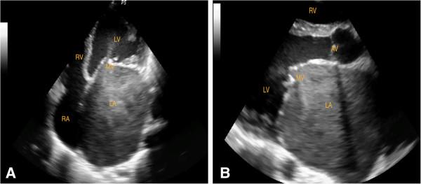 https://cdn.ncbi.nlm.nih.gov/pmc/blobs/8142/4228389/631ecf4156f8/1471-2261-13-95-2.jpg