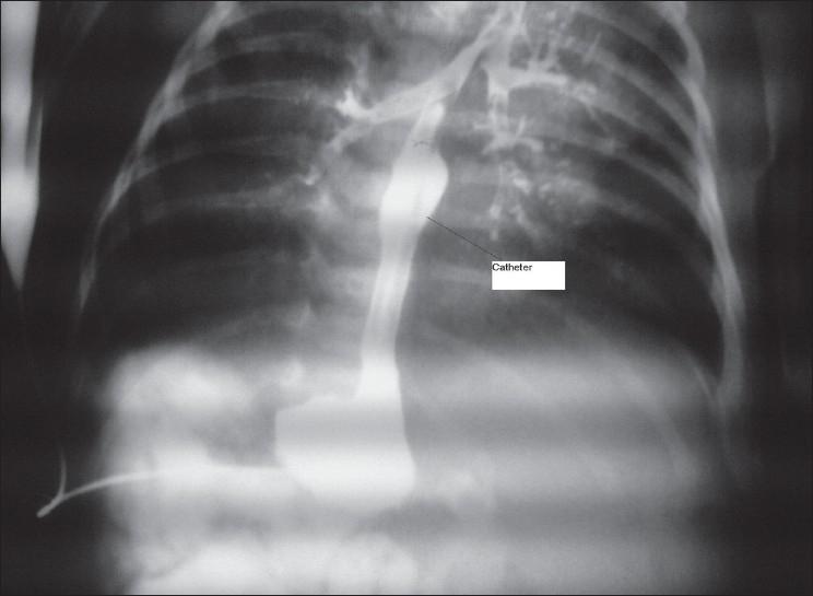 https://cdn.ncbi.nlm.nih.gov/pmc/blobs/8147/2788459/737ee90b15f1/JIAPS-13-118-g001.jpg