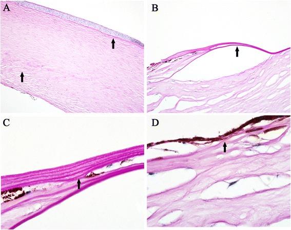 https://cdn.ncbi.nlm.nih.gov/pmc/blobs/8147/4619091/650ee46b424c/12886_2015_131_Fig3_HTML.jpg