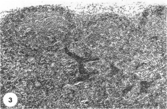 https://cdn.ncbi.nlm.nih.gov/pmc/blobs/814c/1409279/45282450e317/immunology00409-0078-b.jpg