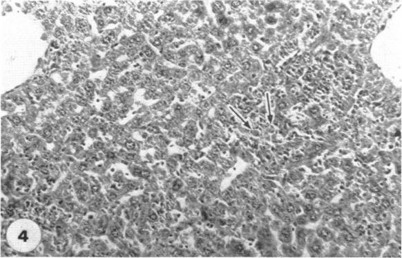 https://cdn.ncbi.nlm.nih.gov/pmc/blobs/814c/1409279/eaa1c071dfba/immunology00409-0078-c.jpg