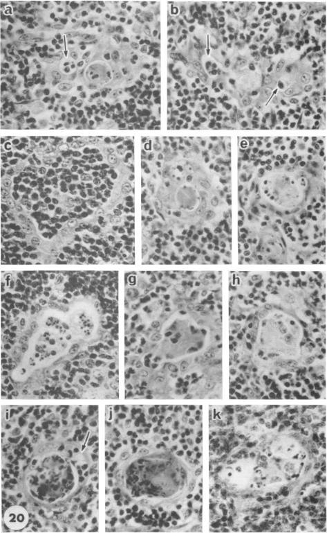 https://cdn.ncbi.nlm.nih.gov/pmc/blobs/814c/1409279/eeb60e240843/immunology00409-0085-a.jpg