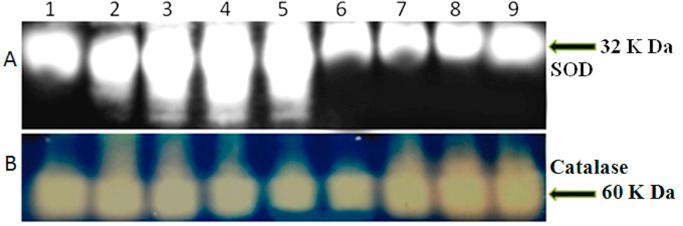 https://cdn.ncbi.nlm.nih.gov/pmc/blobs/815c/5614682/75f2cd439335/gr3.jpg