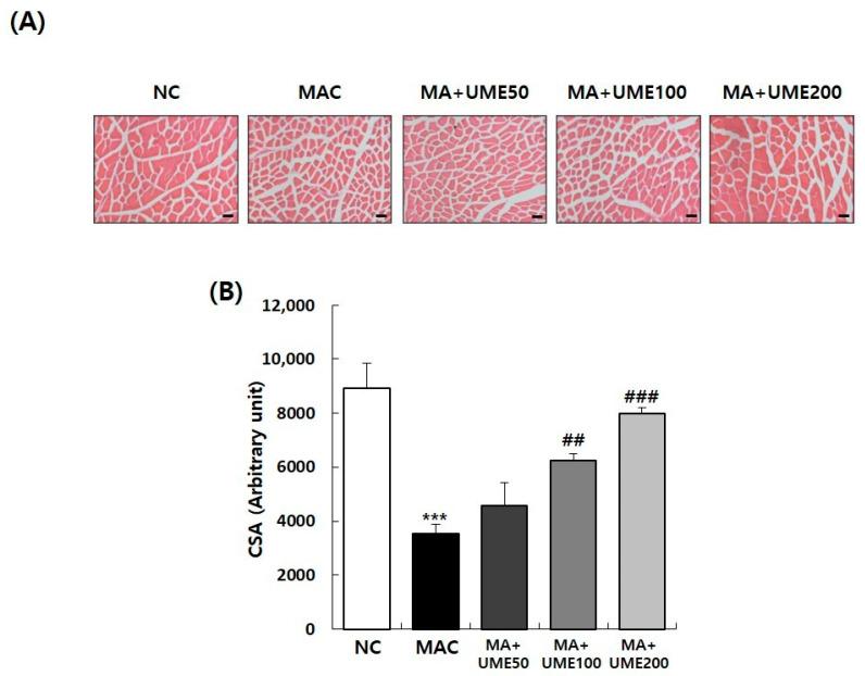 https://cdn.ncbi.nlm.nih.gov/pmc/blobs/8162/11172872/da81c1b574a1/ijms-25-06197-g005.jpg