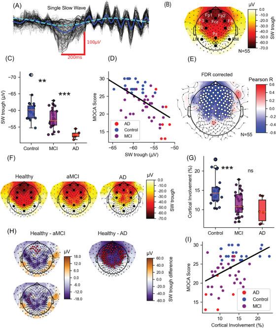https://cdn.ncbi.nlm.nih.gov/pmc/blobs/8162/12094885/89ca53797b32/ALZ-21-e70247-g002.jpg