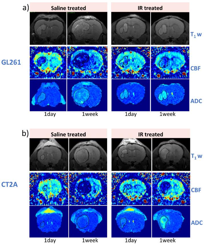 https://cdn.ncbi.nlm.nih.gov/pmc/blobs/8163/12025692/8d574ae01373/cancers-17-01258-g003a.jpg