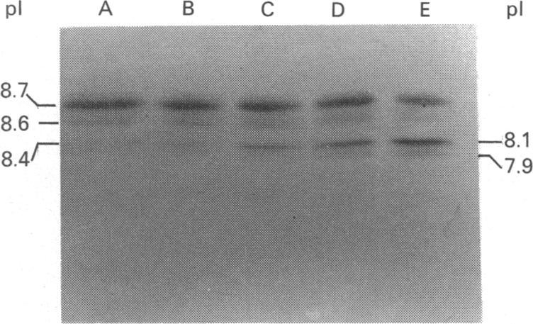 https://cdn.ncbi.nlm.nih.gov/pmc/blobs/8165/1151075/3afbbbd2cfeb/biochemj00157-0229-a.jpg