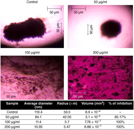 https://cdn.ncbi.nlm.nih.gov/pmc/blobs/8167/11572278/e1de80f403aa/IFSO_A_2419806_F0004_C.jpg