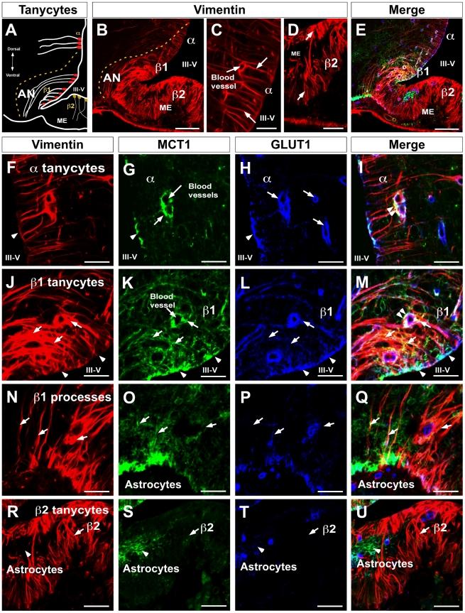 https://cdn.ncbi.nlm.nih.gov/pmc/blobs/8179/3030577/e050a49accb7/pone.0016411.g002.jpg