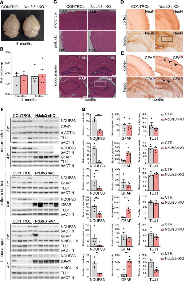 https://cdn.ncbi.nlm.nih.gov/pmc/blobs/817a/7710273/b84436e5f255/jciinsight-5-141183-g104.jpg