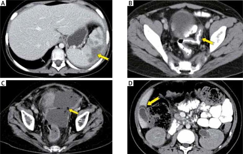 https://cdn.ncbi.nlm.nih.gov/pmc/blobs/817c/6238089/70695ff803a0/WO-22-78932-g003.jpg