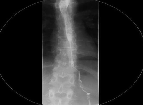 https://cdn.ncbi.nlm.nih.gov/pmc/blobs/817e/5670270/0413bbeffee5/ejohg-07-191-g002.jpg