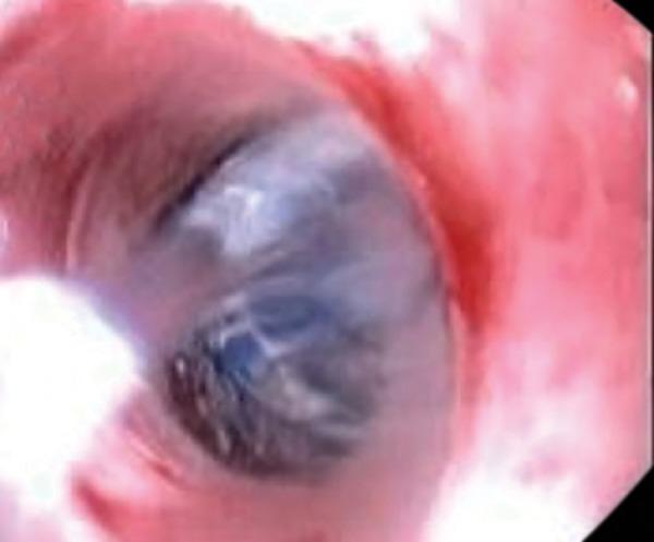 https://cdn.ncbi.nlm.nih.gov/pmc/blobs/817e/5670270/9dd44230bf03/ejohg-07-191-g001.jpg
