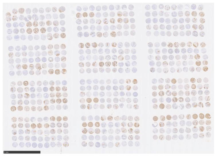 https://cdn.ncbi.nlm.nih.gov/pmc/blobs/818d/10217459/ab17240a640a/curroncol-30-00356-g001.jpg