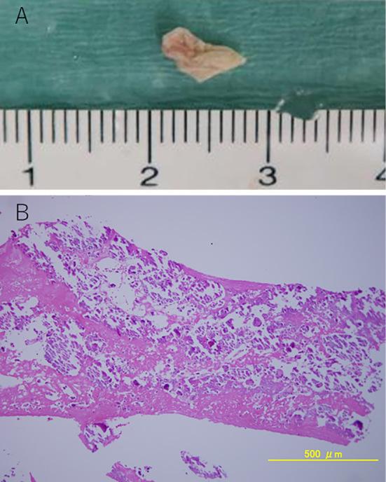https://cdn.ncbi.nlm.nih.gov/pmc/blobs/818d/8355388/d679d59741f2/1349-7235-60-2315-g002.jpg